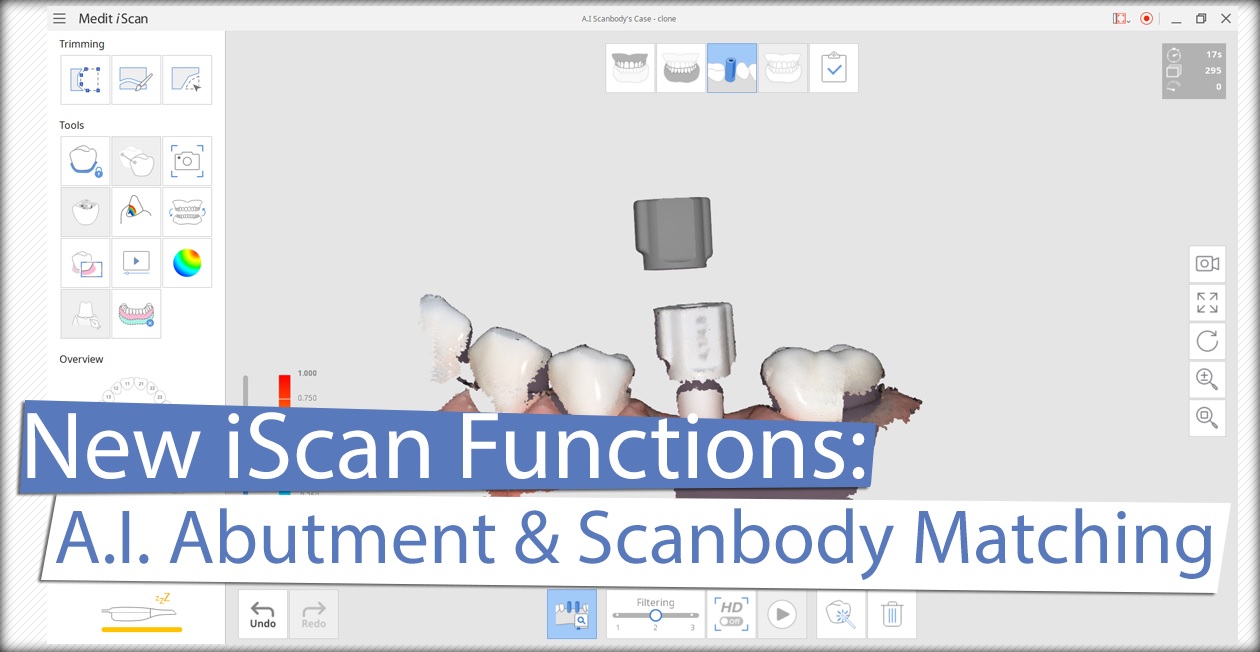 New iScan Functions: A.I. Abutment and Scanbody Matching